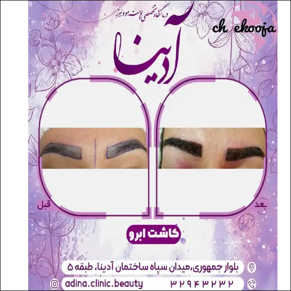 کلینیک آدینا قم